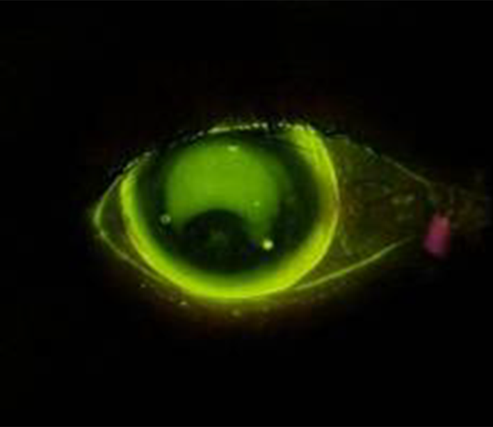 F-SCOPE